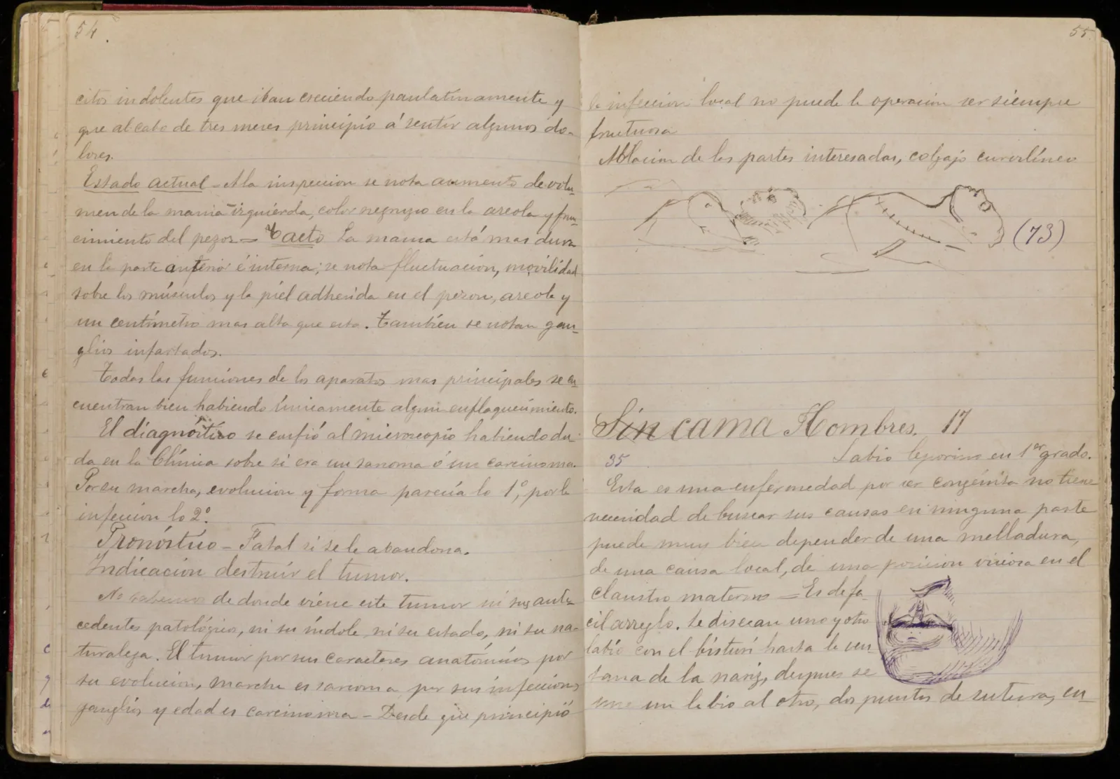Page 54-55 of Clínica Médica Page 54-55 of Clínica Médica. Across the pages are medical notes and anatomical sketches.